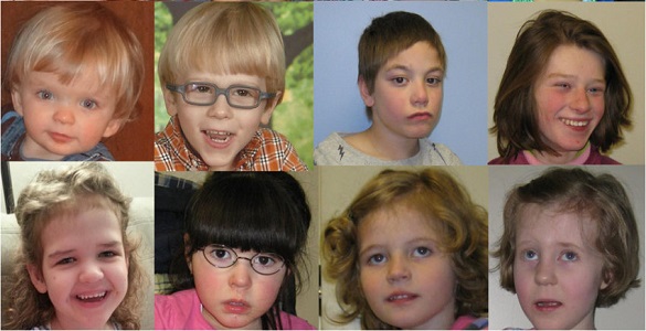 faces de diversas crianças com Síndrome Phelan-McDermid.